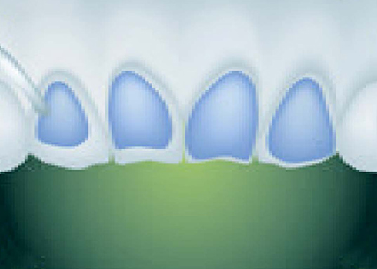 Product detail image